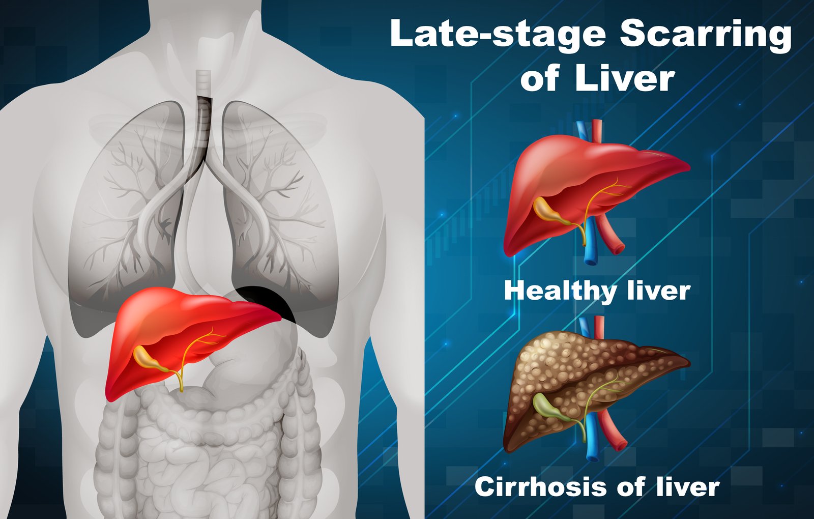 Liver Care
